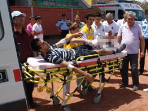 Motosiklet sürücüsünün ayağı koptu