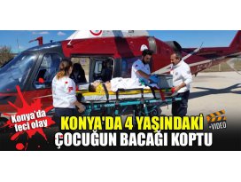 Konyada 4 yaşındaki çocuğun bacağı koptu