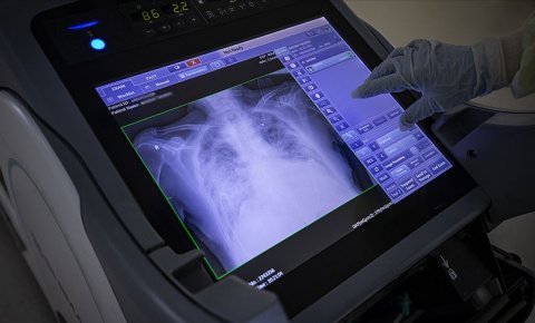Türkiyede son 24 saatte 1703 kişiye Kovid-19 tanısı konuldu, 57 kişi vefat etti