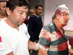 Parasını almaya gitti hastanelik oldu
