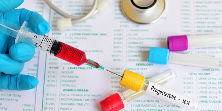 Progesteron Hormonu Nedir? Ne İşe Yarar?