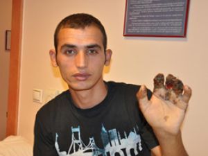 Parçalanan kemiklerden yeni parmaklar