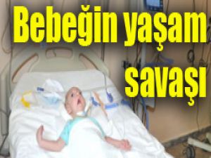 Solunum cihazına bağlı