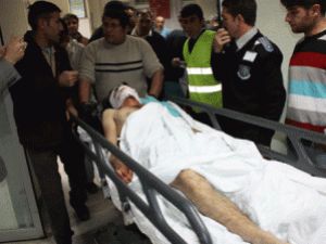 Polise Atmak İstediği Bomba elini kopardı