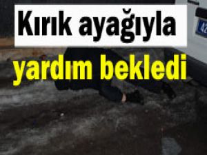 Kaydı düştü, ayağı kırıldı