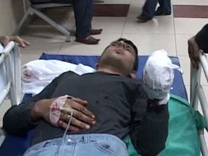 Bomba yüzünden 4 parmağı koptu