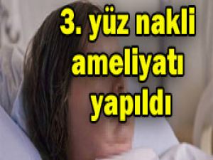 Üçüncü yüz nakli tamamlandı