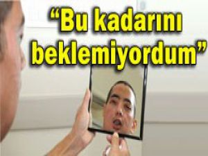 Yeni yüzünü ilk kez gördü