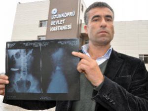 Karnında unutulan bıçakla 9 yıl yaşadı