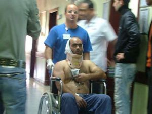 Yem kırma makinesine kulağını kaptırdı