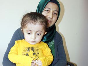 "Cam Kemik" hastası bebek umut ışığı oldu