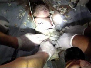 Tuvalet borusuna bebeği yanlışlıkla düşürmüş
