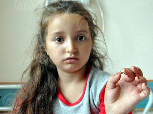 Ayşenin yuttuğu diş akciğerinden çıkarıldı