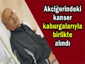 Nadir rastlanan bir durum