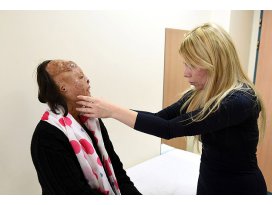 Yeni yüzüyle hayallerine kavuşmak istiyor
