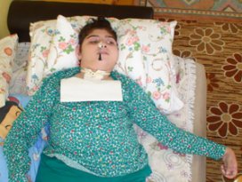 14 yaşındaki engelli Gülce burnundan besleniyor