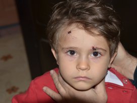 Sokak köpekleri 3 yaşındaki çocuğu yaraladı