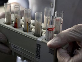 Hepatit B tarihe karışacak