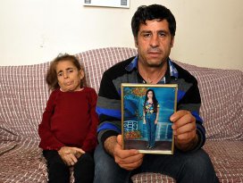 Hastalığı nedeniyle adeta eriyor