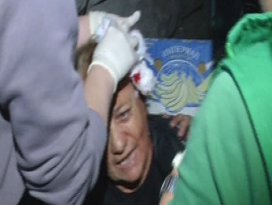 Gürcistan’da muhalif milletvekilinin aracında patlama