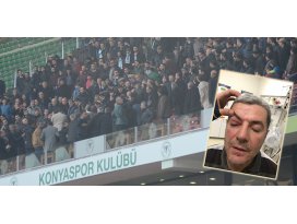 Trabzon maçında kaşı açılan yönetici konuştu